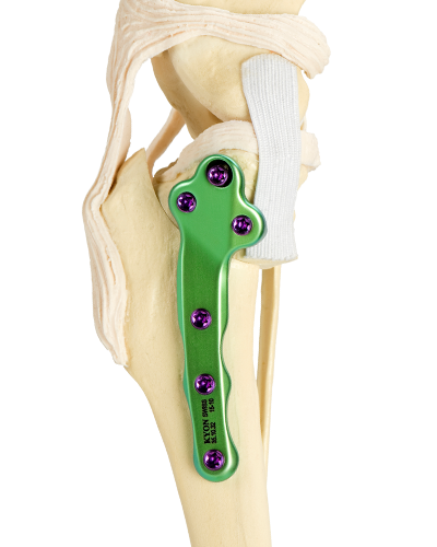 Picture for category Pre-Op 